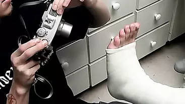 Foot Cast For Poor Evan - Evan Heinze And Ian Madrox
